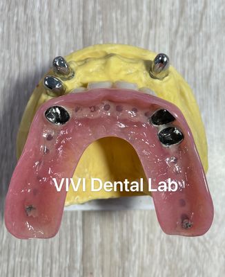 CAD CAM Tooth Partial Denture Attachment Dental Professional Accurate