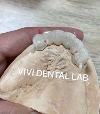 CAD CAM Attachment Partial Denture Dental Crows And Bridges