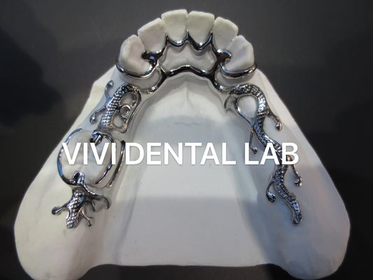 Alloy Metal Partial Denture Framework 3 Shape Exocad Laser Printing