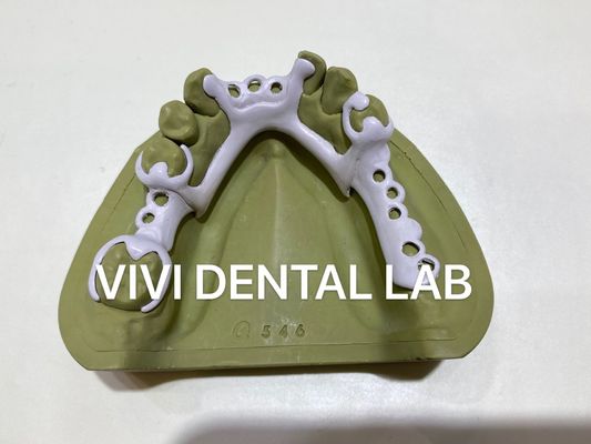 High Accuracy Flexible RPD Denture Designed Milled PEEK Partial Denture
