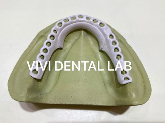 High Accuracy Flexible RPD Denture Designed Milled PEEK Partial Denture