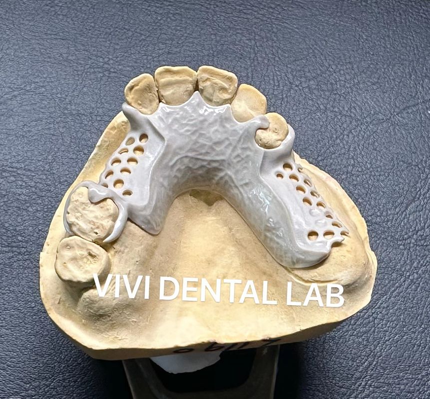 Peek partial framework ISO CE and FDA China dental lab ISO CE and FDA