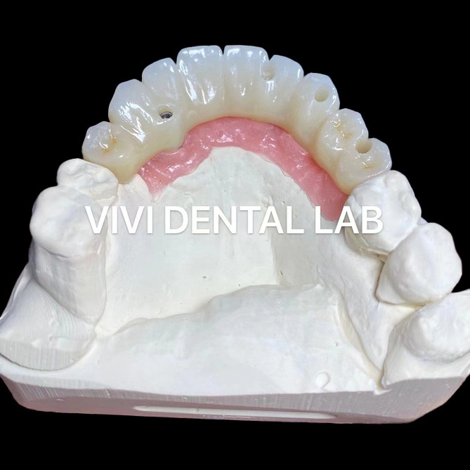 PMMA Accuracy Full Zirconia Bridge Over Multi Unit Abutments