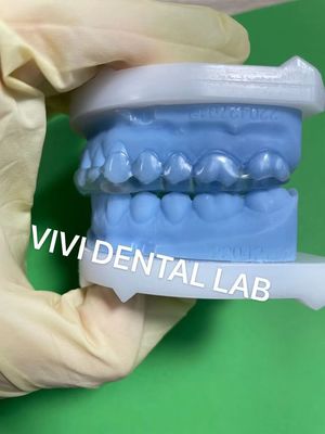 Stable Michigan Splint Dental Splint with Perfect Fit and Professional Quality