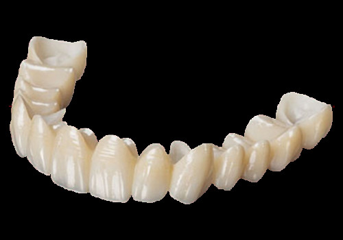 High Esthetics Full Contour Zirconia Crown