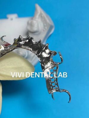 Skelete Chrome Metal Partial Denture Printed CoCr Denture Design
