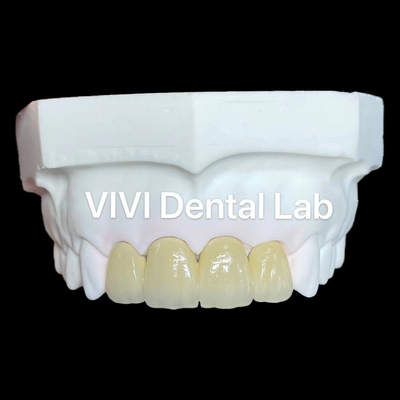 Zirconia Crowns PFZ Zirconia Porcelain Crown Dental Tooth Crown