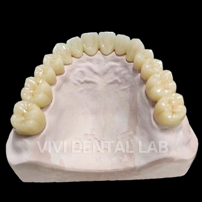 Dental Full Bridge Total Bridge Professional Complete Bridge
