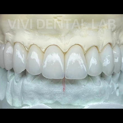Dental Lab Zirconia Crowns And Bridge Works Professional Stable