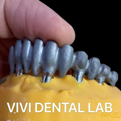 Printed PFM Bridge Over Multi Unit Abutments from China Dental Lab