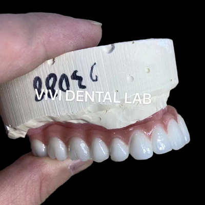 Natural Looking Esthetic Screw Retained Zirconia Implant Crown Long Lasting