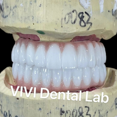 Ni Be Free Zirconia Dental Implant Bridge On Bar High Esthetics