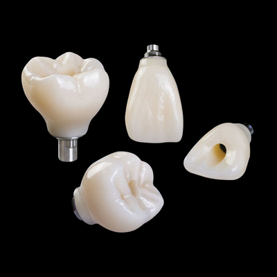 Professional Zirconia Dental Implant Crown Titanium CAD CAM