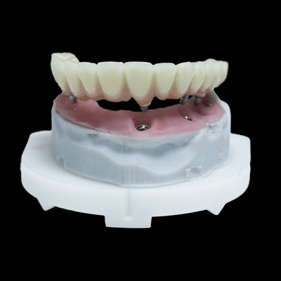 All On 4 PFM Dental Implant Crown Titanium Zirconia All On 6 Restorations