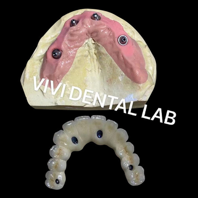 Screwed All On Four Zirconia Bridge Ivoclar Dental High Accuracy
