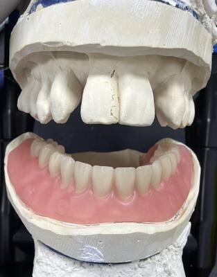 Milled Denture China Dental Lab