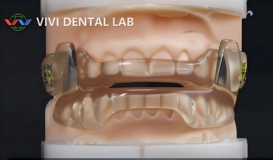 Dorsal Snoring Device china dental lab