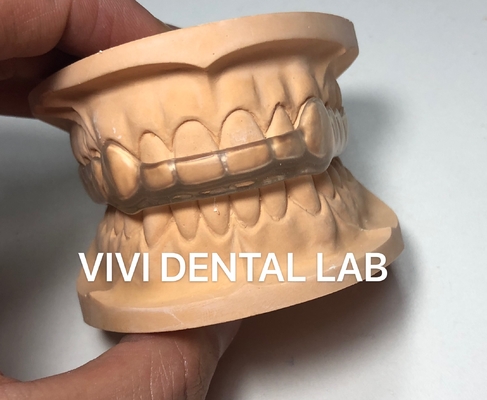 Night Dental Mouth Guard Occlusal Splint Ekodent Good Fit High esthetics