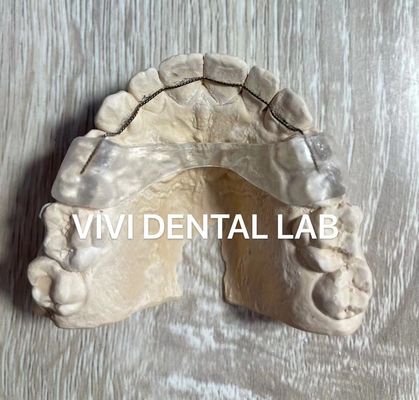 Dental Glass Ionomer Cement Permanent Luting For Crowns Bridges Veneer 20g+10ml