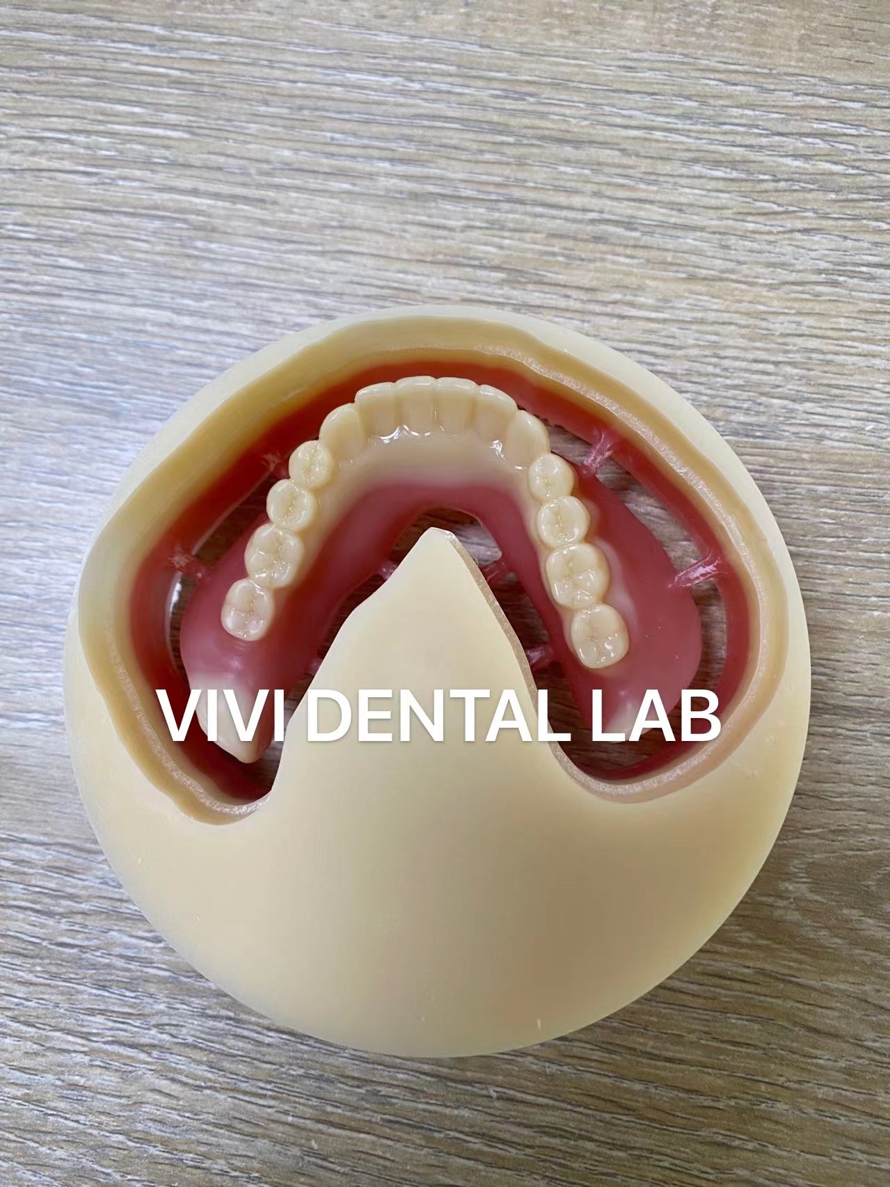 Milled Full Acrylic Denture 3Shape Exocad CAD CAM Digital Complete Dentures