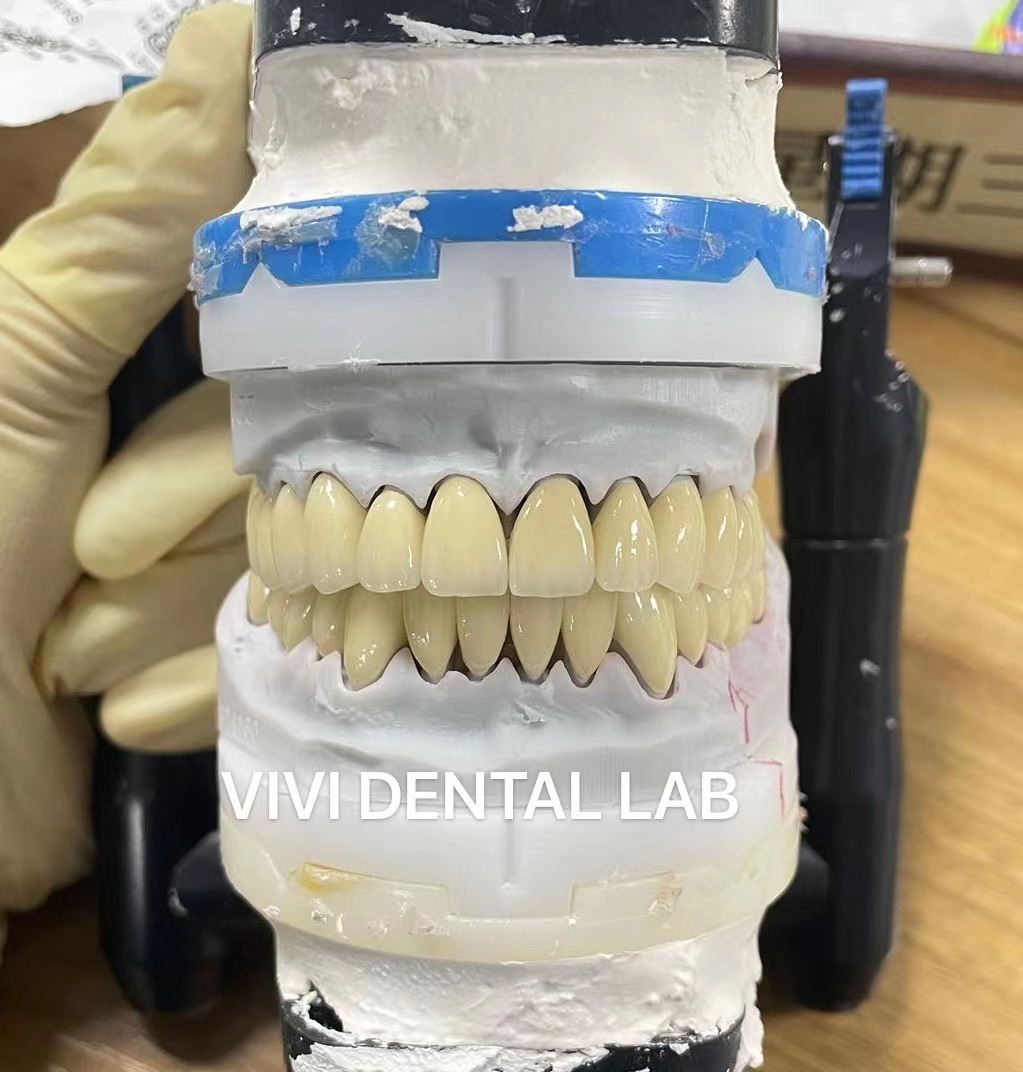 Digital CAD CAM Dental Lab Crowns Translucent Layered Zirconia Crown