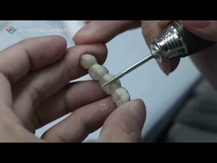 Metal Ceramic Bridge 