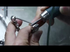 PFM crowns and bridges