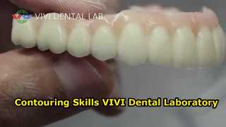 Shape Contouring Skills VIVI Dental Laboratory China