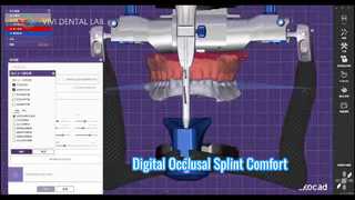 Digital Occlusal Splint Accurate Comfort