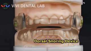 Anti Snoring Dental Device