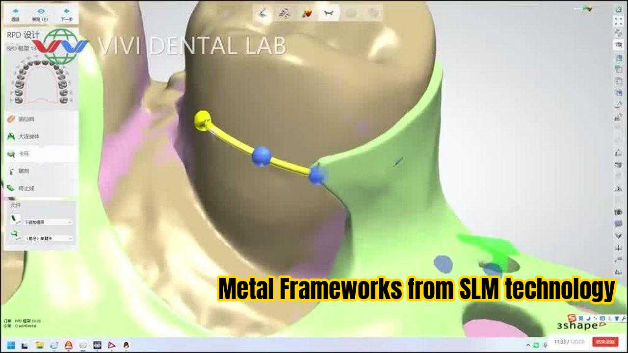 China VIVI DENTAI LABORATORY certification