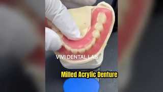 Milled Acrylic Denture High Quality