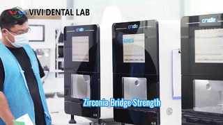 Zirconia Bridge Strong Esthetic VIVI Dental Lab